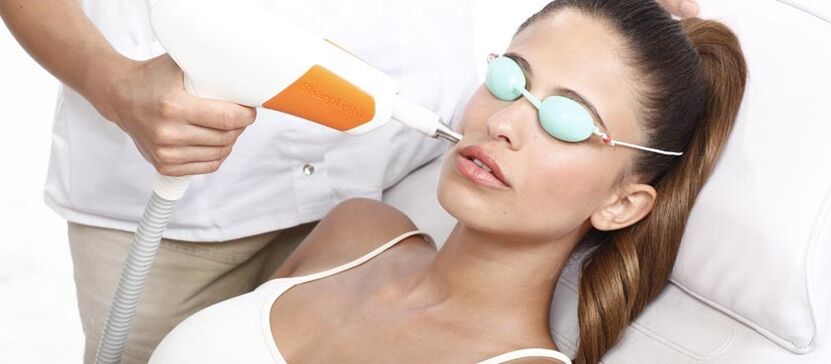 Laserhuidvernieuwing